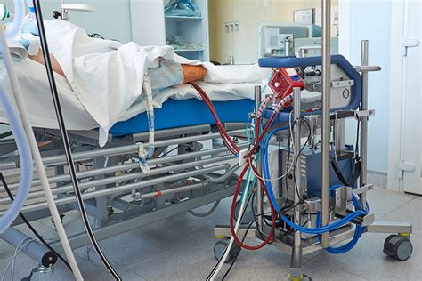 ECMO Gets a Win in Severe COVID-19 | MedPage Today