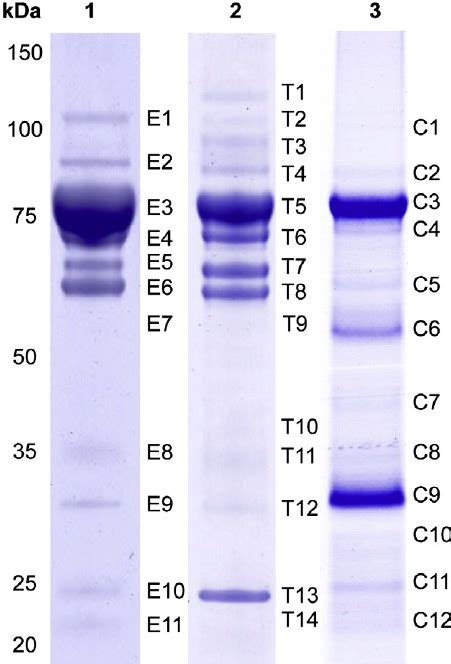 Electrophoretic Profiles Of Trypanosoma Rangeli Epimastigotes And