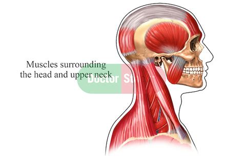 Origin Of A Tension Headache Doctor Stock