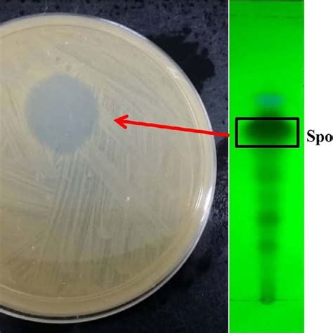 Anti Mrsa Activity Of Fungal Extracts On Disc Diffusion Assay