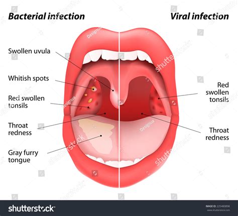 Mouth And Teeth Diagram