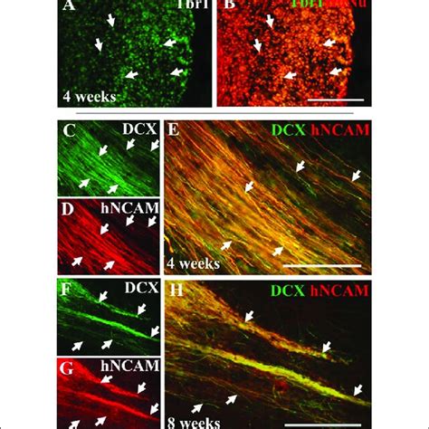 Ipsc Derived Hnpcs Express Deep Layer Cortical Neuron Markers And