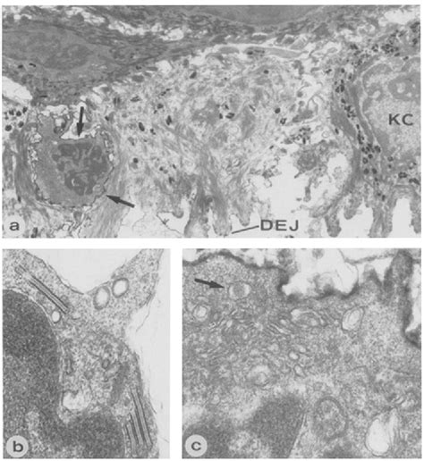 Figure 2 From Human Epidermal T Cells Predominantly Belong To The