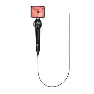 Endoscope Camera Shenzhen Tuyou Medical Imaging Co Ltd Medical