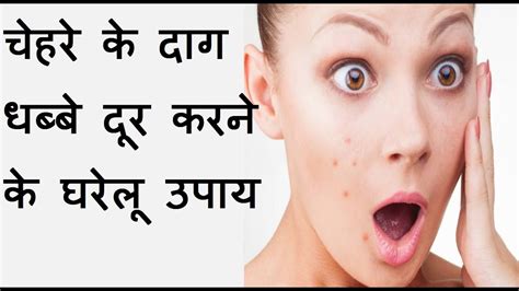 How To Remove Pimples From Face And Get Rid Of Acne कील मुहांसो से