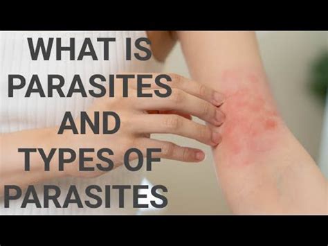 What Are Parasites And Its Types Of Parasites Urdu Hindi YouTube