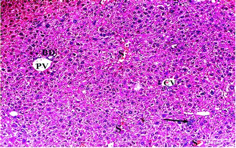 A Photomicrograph Of A Section Of Liver Of Hcc Treated With Iq