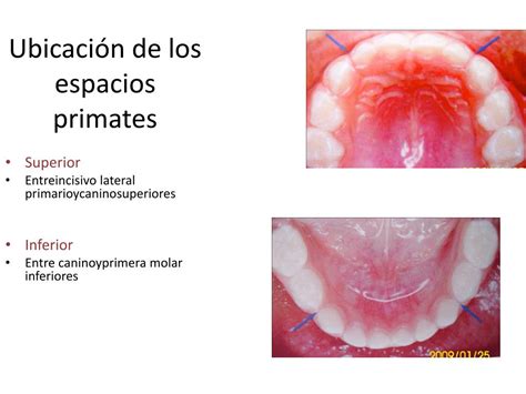 Ppt Examen Diagn Sticoy Plan De Tratamiento Powerpoint Presentation