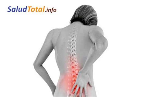 La Hiperlordosis Causas S Ntomas Ejercicios Y Tratamiento