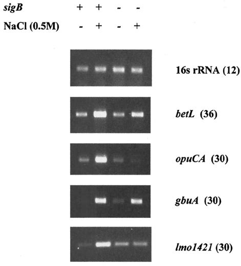 Rt Pcr Analysis Of Compatible Solute Transporter Tran Script Levels