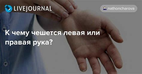 Почему чешется левая ладонь с медицинской точки зрения - фото презентация