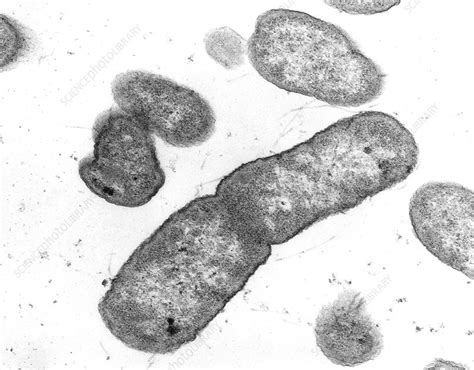 Salmonella typhimurium bacteria - Stock Image - B220/0307 - Science ...