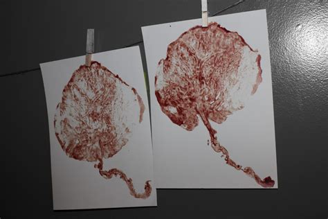 Placenta Keepsake Prints and Art - Placenta Encapsulation Services