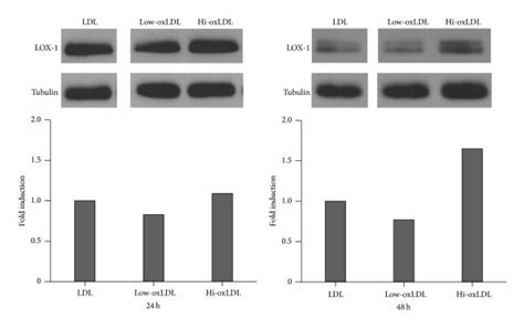 Expression Of Lox 1 In Response To Oxldl Thp 1 Cells Were Treated With