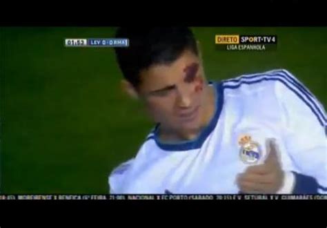 Vid O De Cristiano Ronaldo D Couvrez L Impressionnante Blessure L