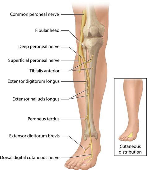 Common Peroneal Nerve Dysfunction Pictures