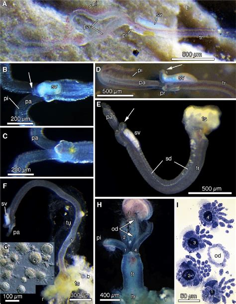 Osedax priapus n. sp. Male and Female Anatomy | Download Scientific Diagram