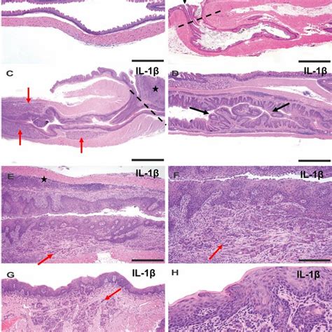 Squamous Dysplasiaescc Incidence In Il 1β Mice At 1215 Months In Gf Download Scientific