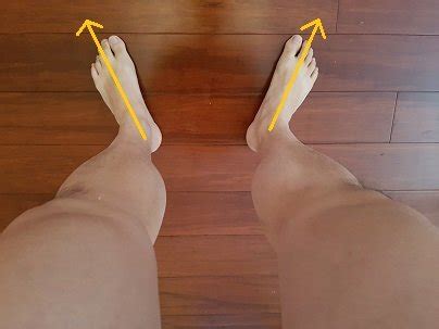 How to fix Duck feet posture - Posture Direct