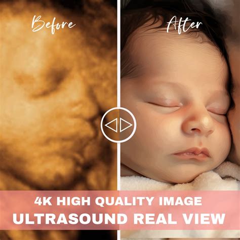 8k Enhanced Ultrasound From Bumps To Realistic Faces Precision 3d 4d