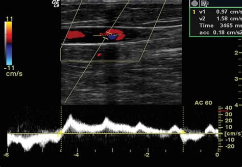 Arterial & Venous Doppler Ultrasound | K & T Diagnostic, Inc.