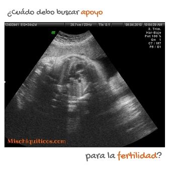 Cu Ndo Debo Acudir A Una Consulta De Fertilidad Mis Chiquiticos