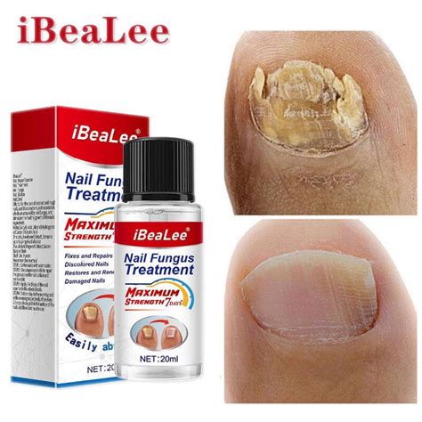 Ibealee Nail Fungus Treatment Rawatan Kulat Kuku Baiki Kuku Rosak Pecah