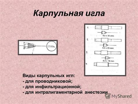 Презентация на тему: "Тема : Обезболивание в терапевтической ...
