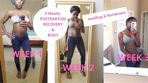 3 Weeks Postpartum Body Recovery C Section Csection Postpartum