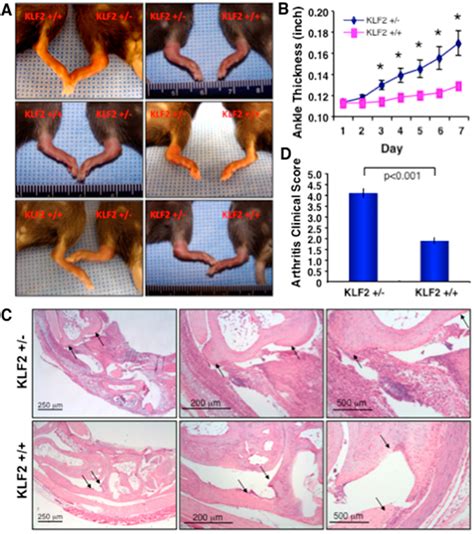 Cells Free Full Text Myeloid Krüppel Like Factor 2 Critically