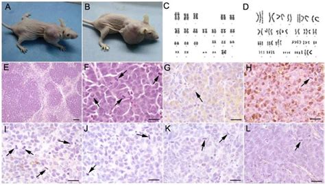 Subcutaneous Tumorigenesis In Immunodeficient Nude Mice Injected With