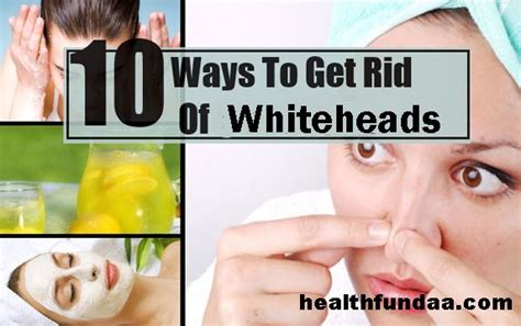 How To Get Rid Of Whiteheads 10 Best Home Remedies Health Fundaa