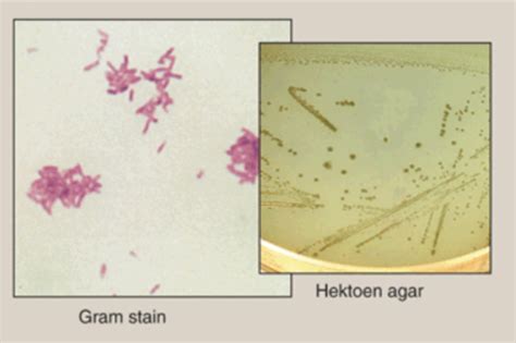 Enterobacteriaceae Escherichia Coli Salmonella Shigella Flashcards