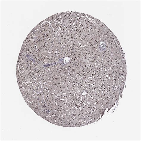 Tissue Expression Of Ppara Staining In Liver The Human Protein Atlas