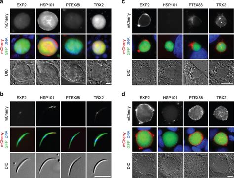 Live Imaging Of Four Ptex Components During Plasmodium Berghei Life Download Scientific Diagram