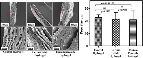 Left Image Sem Images Of Control Hydrogel Cerium Oxide Hydrogel