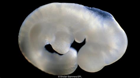 Human Animal Chimeras Now Grown On Us Research Farms Truth And Action