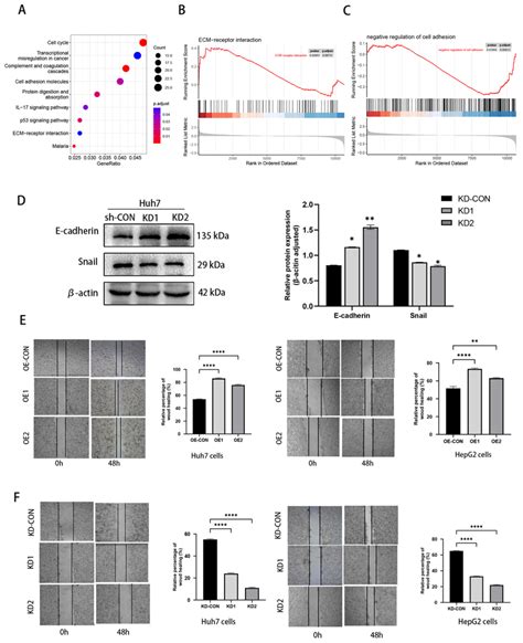 Nox4 Promotes Tumor Migration In Vitro By Inducing Emt A The Bubble