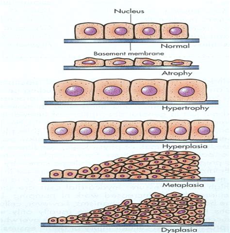 Pathophysiology Cellular Adaptation Flashcards Quizlet