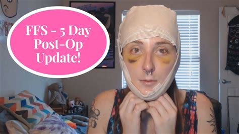 Ffs 5 Day Recovery Timeline Compilation Mtf Transgender Youtube