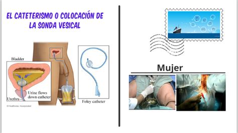 El Cateterismo O Colocaci N De La Sonda Vesical By On Prezi