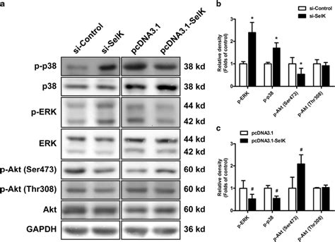 The Erk P Mapk And Akt Signaling Pathways Are Involved In The