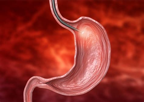 Important Things To Know About Pediatric Upper Gastrointestinal