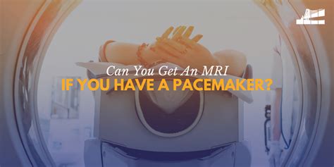 Can You Get An MRI If You Have A Pacemaker? — Bay Imaging Consultants