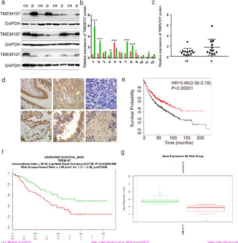 Tmem Expression Is Lower In Nsclc Tissues And Correlates With Poor