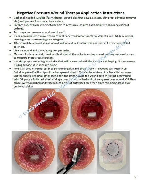 Negative Pressure Wound Therapy Instructions With Photos - Etsy