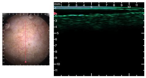 Cancers Free Full Text Digitally Enhanced Methods For The Diagnosis