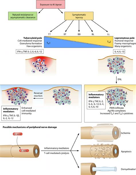 The Leprosy Spectrum And Possible Mechanisms Of Tissue Damage Leprosy