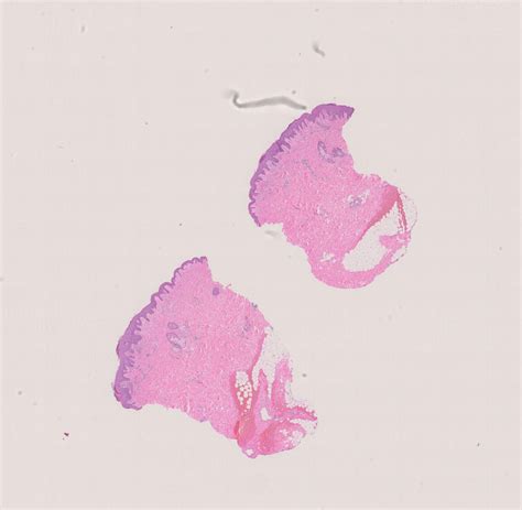 Matching Which Clinical Goes With The Dermpath 1st 2nd Or 3rd