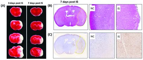 Characterization Of Cerebral Ischemia Stroke In Mouse Download Scientific Diagram